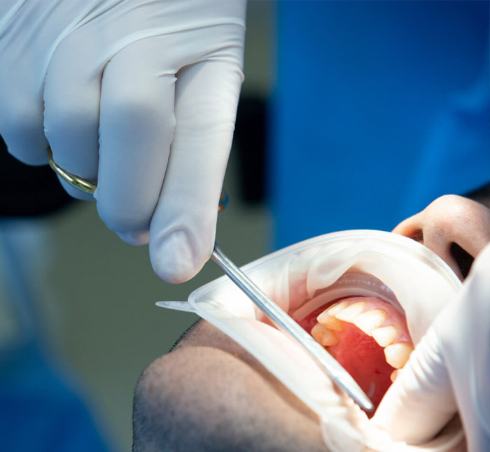 Close up view of young adult woman that have a visit in the dentist clinic. Conception of stomatology