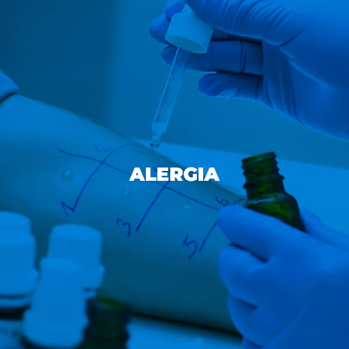 especialidades-medicas-rio-de-janeiro-alergia1