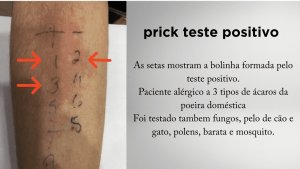 prick teste positivo